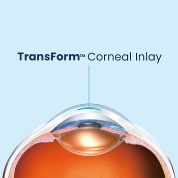 Transform Corneal Inlay 4x4 square_EN Transform Corneal Inlay 4x4 square_EN