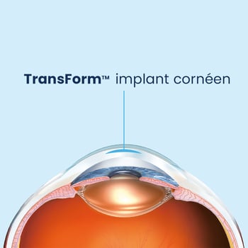 Transform Corneal Inlay 4x4 square_FR Transform Corneal Inlay 4x4 square_FR